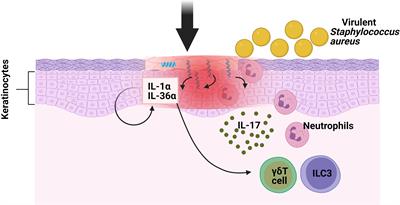 Type 3 Innate Lymphoid Cells as Regulators of the Host-Pathogen Interaction